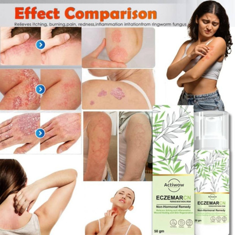 ACTIWOW Eczemaron Fungal Infection Treatment – Skin Relief – 3-Pack ...