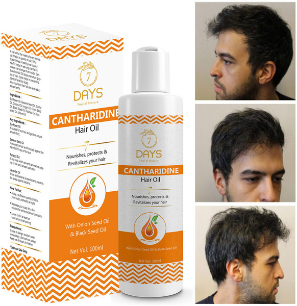 Buy 7 Days Cantharidine Oil 500ml | Hair oil for hair Growth & Controls Hair  Fall | cantharidine oil for hair | cantharidine beauty hair oil Online at  Low Prices in India - Amazon.in