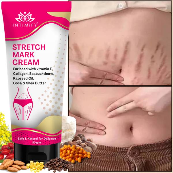 INTIMIFY Pregnancy Stretch Mark Cream, Moisturises & Soothens Skin for women