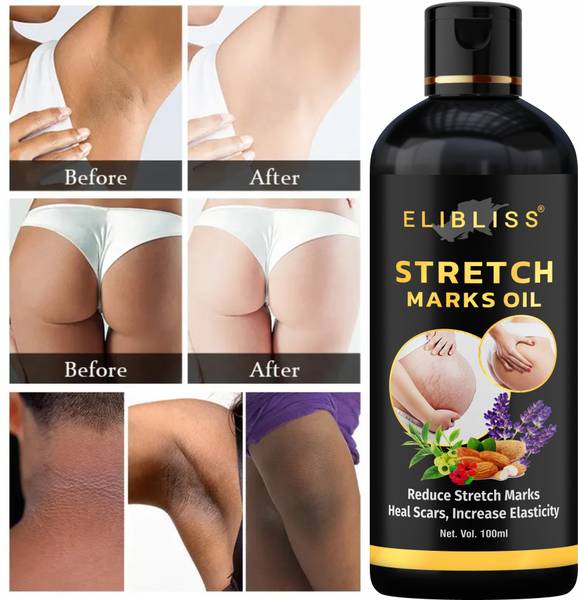 ELIBLISS Stretch Mark Oil for Women & Men - Scars, Uneven Skin Tone & Spots Removal oil