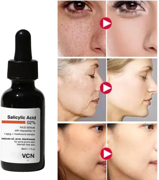 vcn Salicylic Acid Serum 2% for Acne, Blackheads & Open Pores