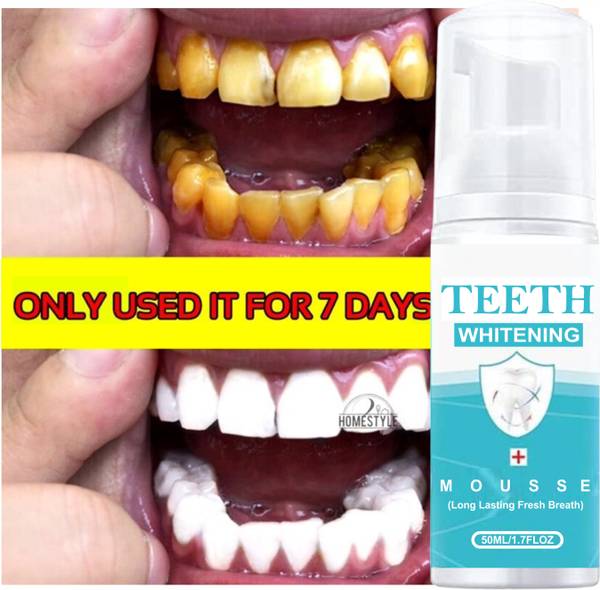 Fresh breath outlet whitening kit