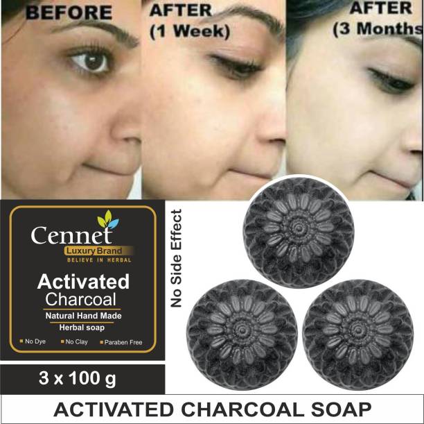CENNET  Activated Charcoal Soap For Women Skin Whitening , Pimples, Blackheads , Acne, Natural Detox Face & Body Soap