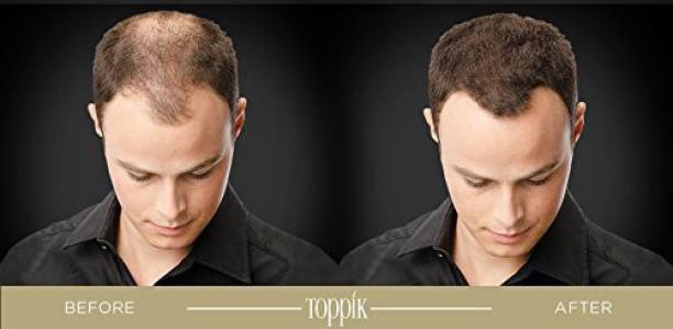 Stylazo TOPPIK Hair Building Styling Fibers Hair Loss concealer ,Black (27.5 g) (27.5 g) 8541524 soft Hair Volumizer powder