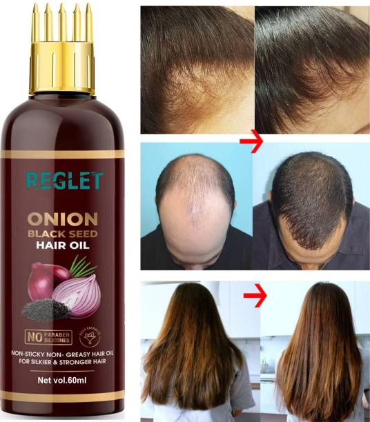 REGLET Onion Oil - Black Seed Onion Hair Oil - WITH COMB APPLICATOR - Controls Hair Fall - NO Mineral Oil, Silicones, Cooking Oil & Synthetic Fragrance Hair Oil
