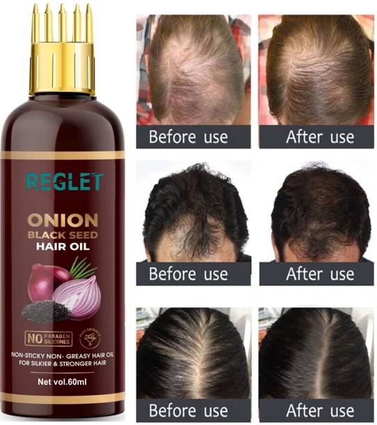REGLET Onion Oil - Black Seed Onion Hair Oil - WITH COMB APPLICATOR m  Hair Oil