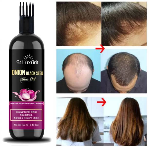 St.Luxurit Black Seed Onion Hair Oil - Controls Hair Fall - NO Mineral Oil, Silicones Hair Oil