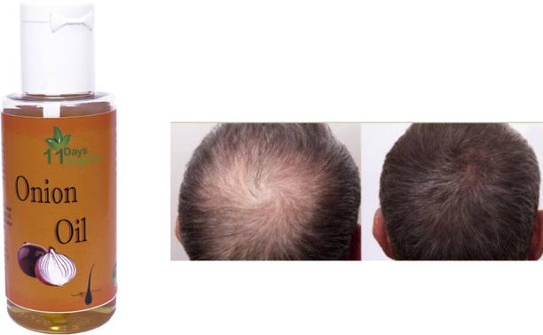 11 Days Organic Beauty And Grooming - Buy 11 Days Organic Beauty And Grooming Online at Best Prices In India 11 Days Organic Beauty And Grooming - Buy 11 Days Organic Beauty And Grooming Online at Best Prices In India