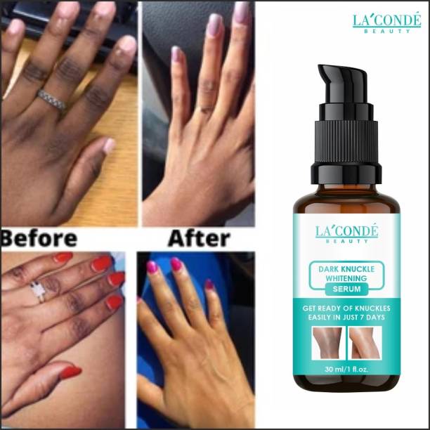 La'Conde Skin Whitening Serum For Dark Knuckles of Hand, Elbows & Knees 30 ML Men & Women