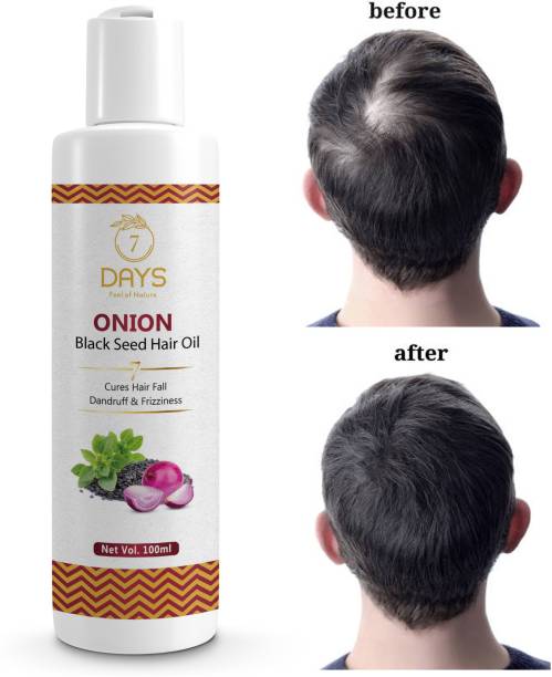 7 Days Onion Oil for Hair Regrowth & Hair Fall Control Hair Oil 100% Pure & Natural RED ONION Herbal Hair Oil - Blend of 14 Natural Oils for Hair Regrowth, Treat hair loss, Dandruff Control & Thickens hair Oil Hair Oil
