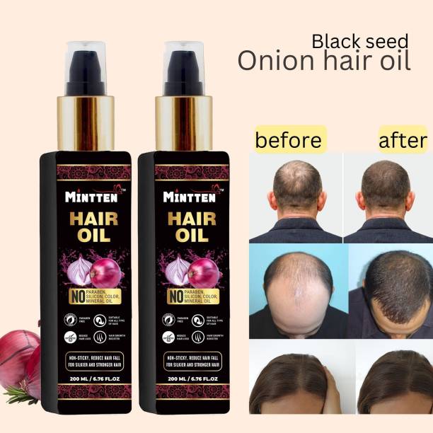 mintten RED ONION HAIR OIL NO SILICON AND MINERAL OIL 200 ML + ROSE WATER 100 ML