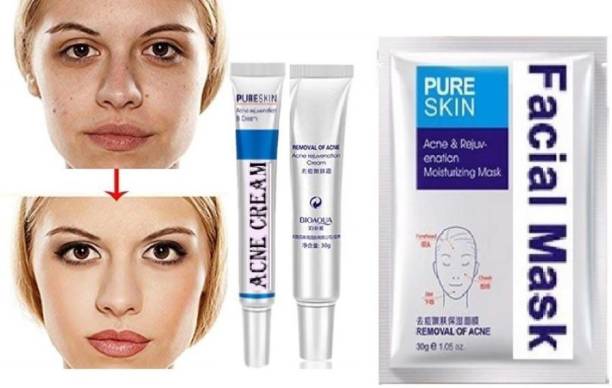 Digital Shoppy 1 Pc Acne Removal Cleanser Cream With acne rejuvenation moisturizing mask.  Face Shaping Mask