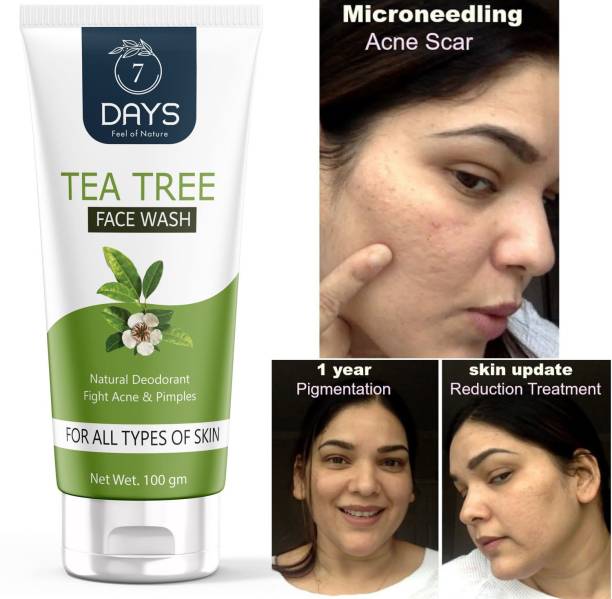 7 Days Organic Tea Tree with Natural Deodorant fight acne & Pimples Face Wash