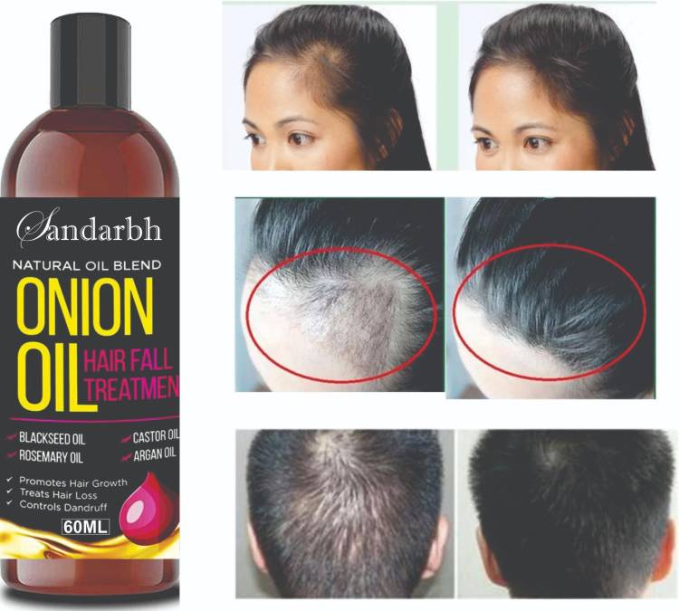 Sandarbh Onion Hair Oil with 14 Essential Oils for Hair Regrowth, Dandruff  Control , Black Seed - Hair