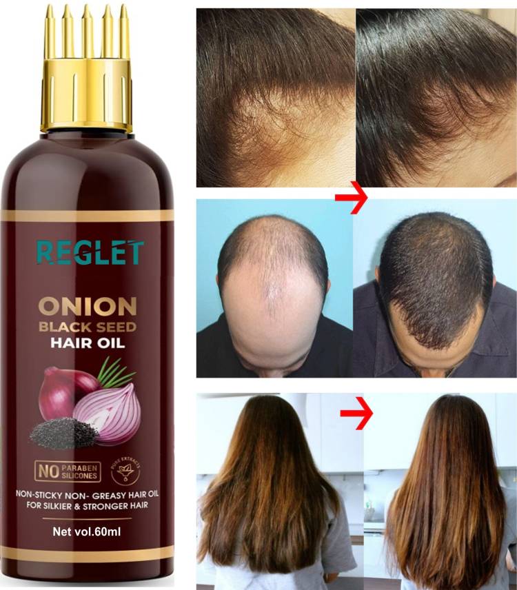REGLET Onion Oil - Black Seed Onion Hair Oil - WITH COMB APPLICATOR - Controls Hair Fall - NO Mineral Oil, Silicones, Cooking Oil & Synthetic Fragrance Hair Oil Price in India