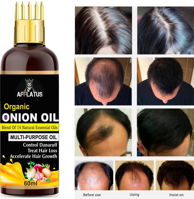 Afflatus Onion Black Seed Hair Oil - WITH COMB APPLICATOR - Controls Hair Fall - NO Mineral Oil, Silicones, Cooking Oil & Synthetic Fragrance Hair Oil Price in India
