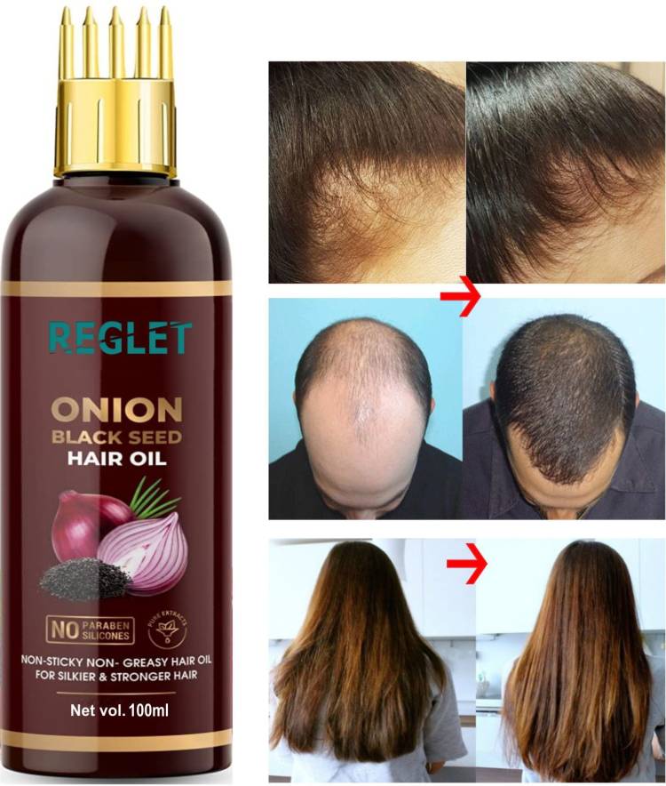 REGLET Onion Oil - Black Seed Onion Hair Oil - WITH COMB APPLICATOR - Controls Hair Fall - NO Mineral Oil, Silicones, Cooking Oil And Synthetic Fragrance Hair Oil Price in India