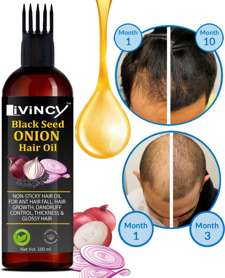 Buy StBotanica Oriental Botanics Onion Hair Care Combo  Red Onion Hair  Shampoo  Red Onion Hair Oil Set of 2 with Red Onion Oil for Strong   Healthy Hair Online at