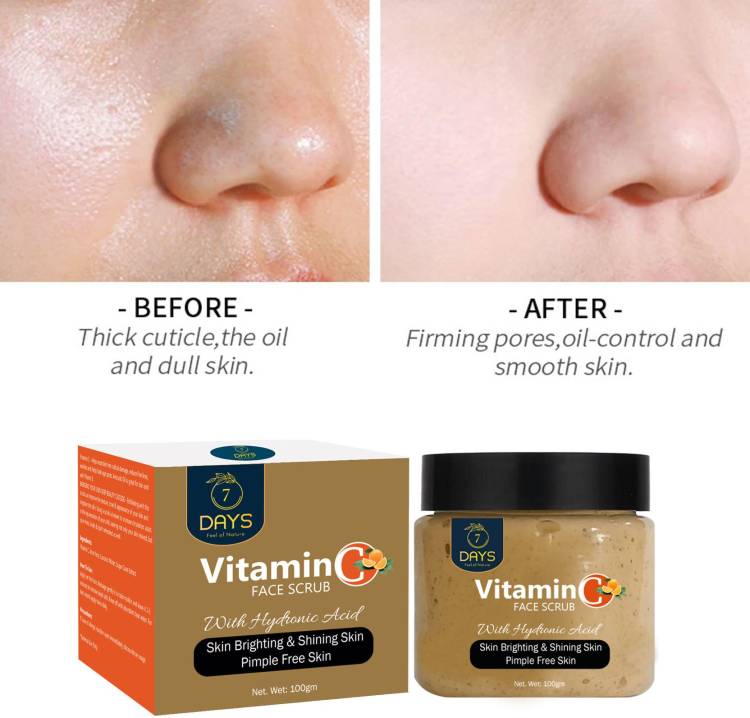 AURA ORGANIC Vitamin C Face Scrub Tan Removal Repair Damage Caused By Sun Acne And Pimples Free Skin  Scrub Price in India