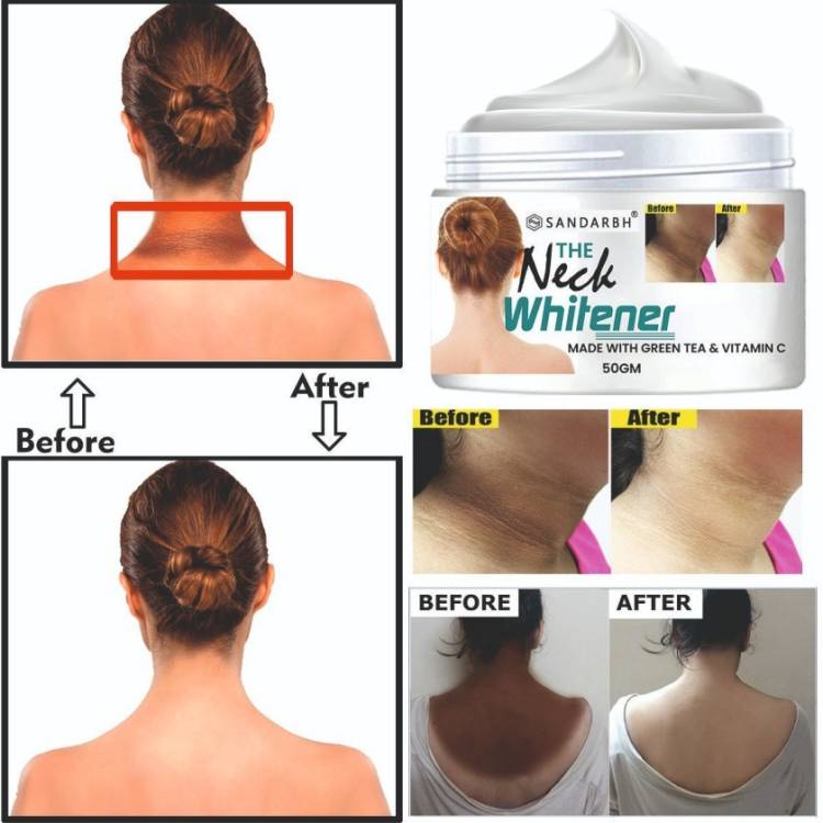 Sandarbh Skin Brightening Cream for Neck|Dark Spot Remover|De-Tan Remover Price in India