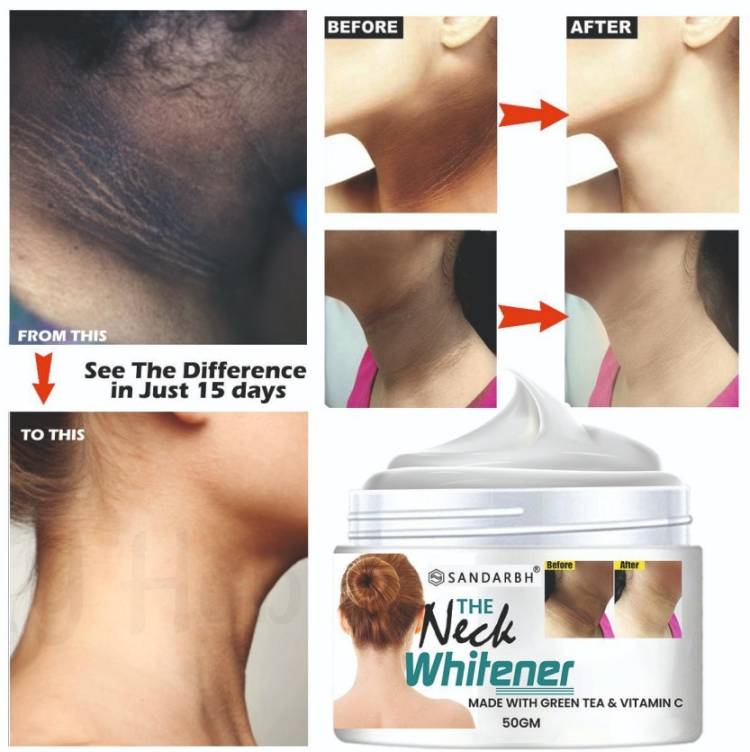 Sandarbh Neck Back Whitening Cream | Removes Fine Lines & Tanning, Lightens, Nourishes, - Price in India