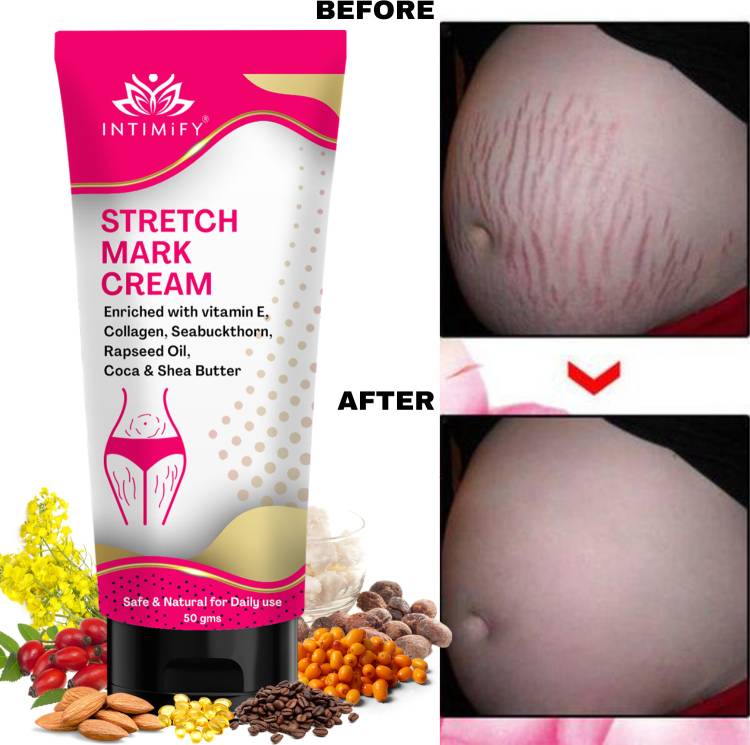 INTIMIFY Pregnancy stretch mark removal cream, Remove Pregnancy Scars For Women 50gm Price in India