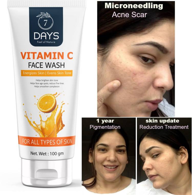 7 Days Vitamin C For Brighten skin tone Help face age spots Reduce fine lines Face Wash Price in India