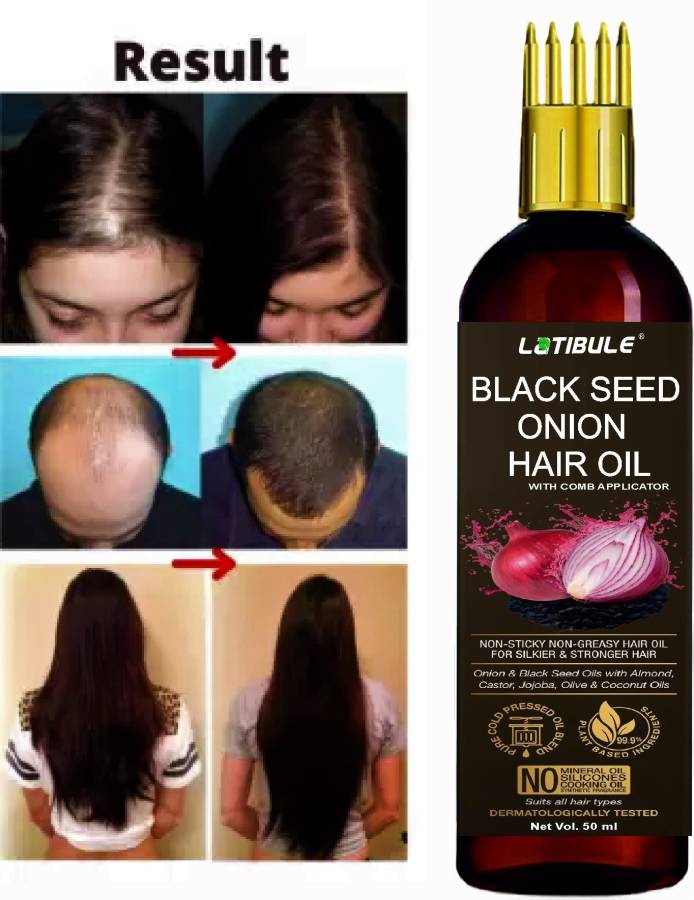 Latibule Black Seed Onion Hair Oil - WITH COMB APPLICATOR - Controls Hair  Fall Hair Oil Price in India, Full Specifications & Offers 
