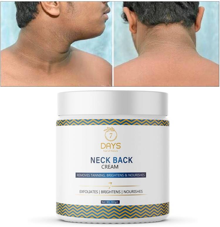 7 Days Neck Back Whitening Cream For Dark Knee, Elbow For Brightning Skin Price in India