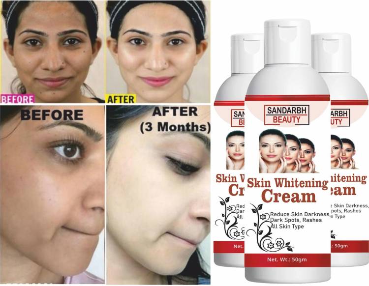 Sandarbh WhiteGlow Skin Whitening And Brightening Instant Glow Cream Price in India