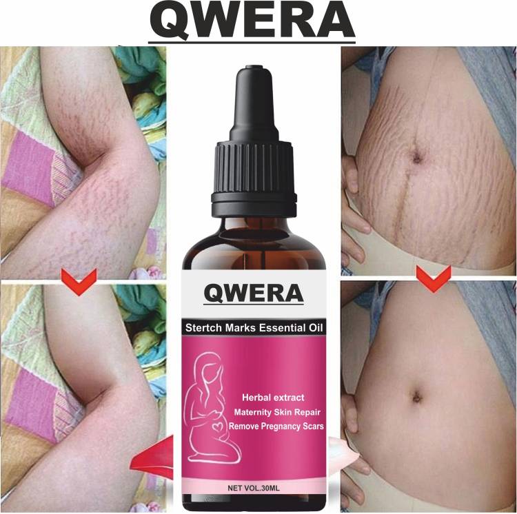 Qwera Stretch Marks Oil to Reduce Stretch Marks & Scars Price in India