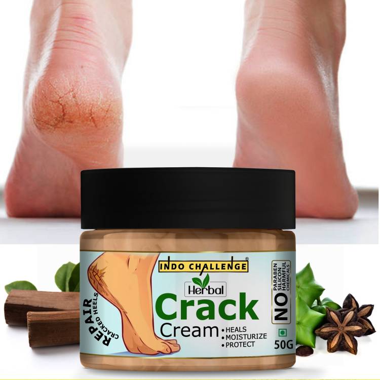 INDO CHALLENGE Herbal Foot Crack Cream For Dry Cracked Heels & Feet Price in India
