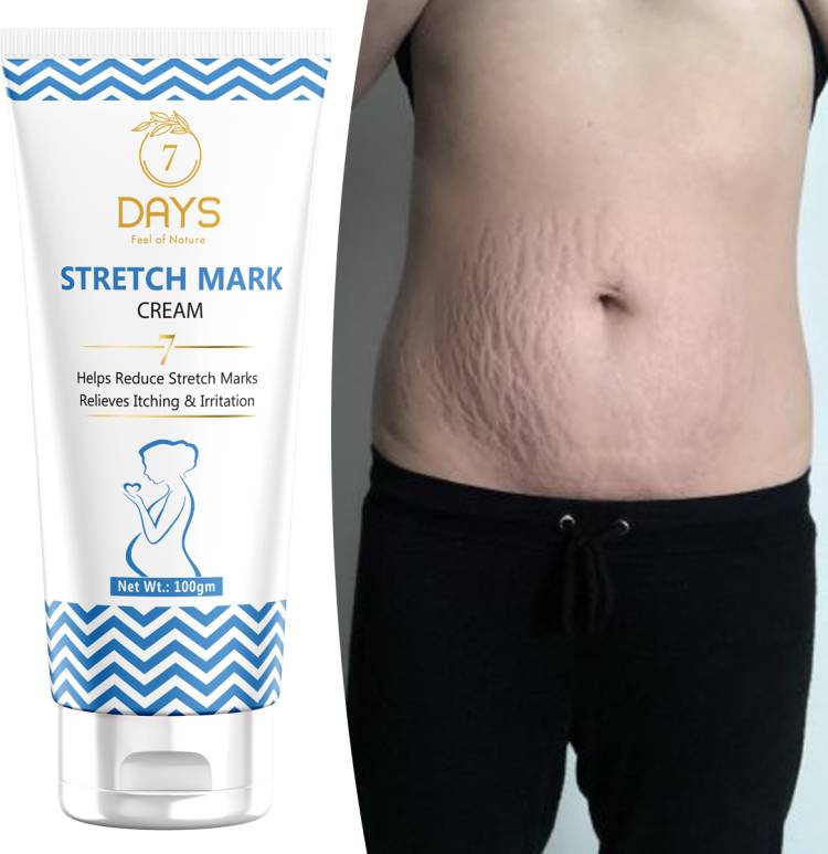 7 Days stretch Cream for Stretch Marks Removal Post Pregnancy fast work 100% result stretch mark cream oil stretch marks on hips Under arms foot lags during pregnancy Price in India