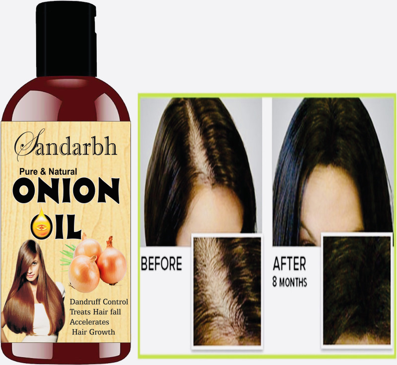 Hair Oil Sandarbh Onion Black Seed Hair Care Growth Shine Tea Tree Oil Omega 3 Vitamin E Hair Oil 100 Ml Husohabe