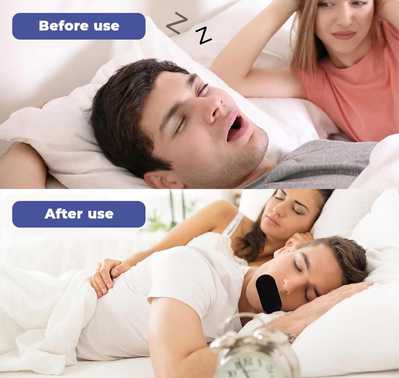 Ramya beauty care Fride 30-Conut Anti-Snore Mouth Tape Mute Snoring Tape Anti-snoring Device(Mouthpiece)