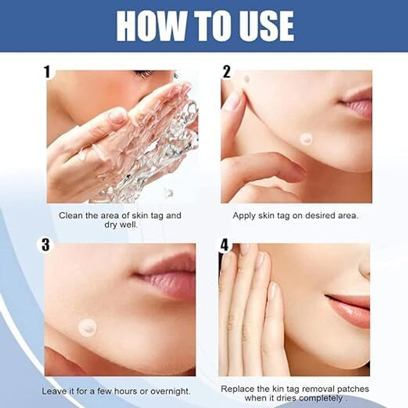 NEWSPARSH Lina Acne Patches, Invisible Pimple Patches, Hydrocolloid Pimple Patches Pimple Patches(White)