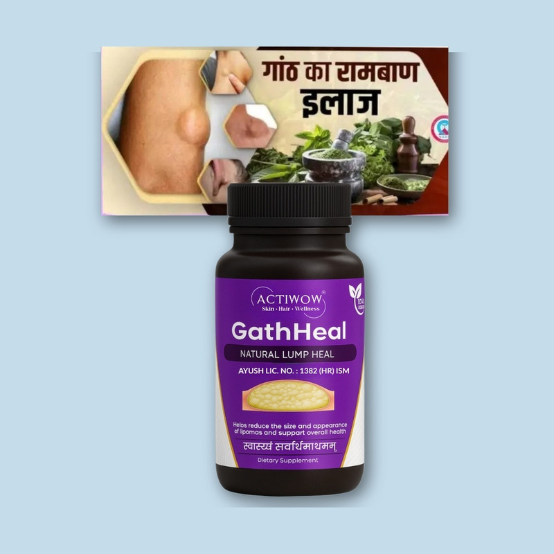 ACTIWOW Gath Heal Capsules for Quick Relief from Painful Gath & Tissue(30 Capsules)