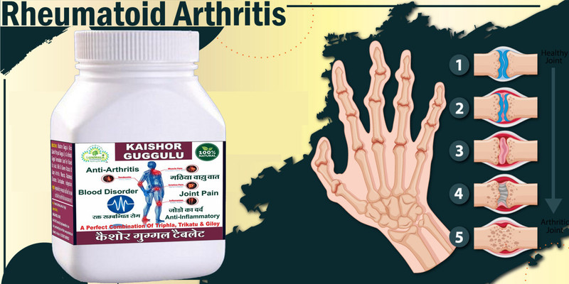 Gunmala Enterprises arthritis medicine | yograj guggulu - 60 tab.(60 Tablets)