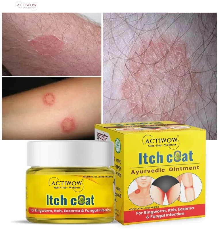 ACTIWOW Itch Coat Cream Natural Anti-Rash Hydrating Skin Cream XAX(50 g)