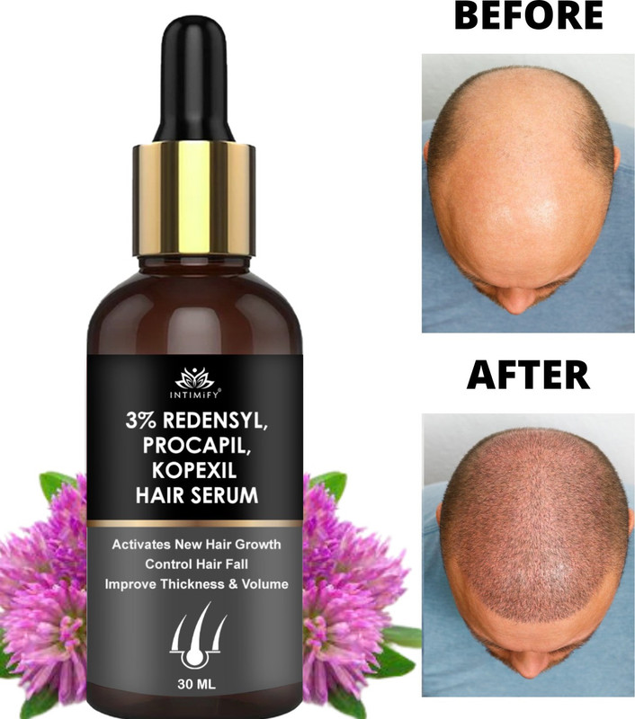 INTIMIFY 3% Redensyl Hair Growth Serum For Hair Fall Control, Delays Hair Greying 30 ml(30 ml)