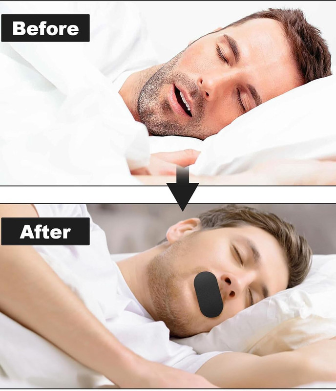 K2J WET 30 Conut for Sleep Anti-Snore Mouth Tape Mute Snoring Tape Pack of 30 Anti-snoring Device(Mouthpiece)