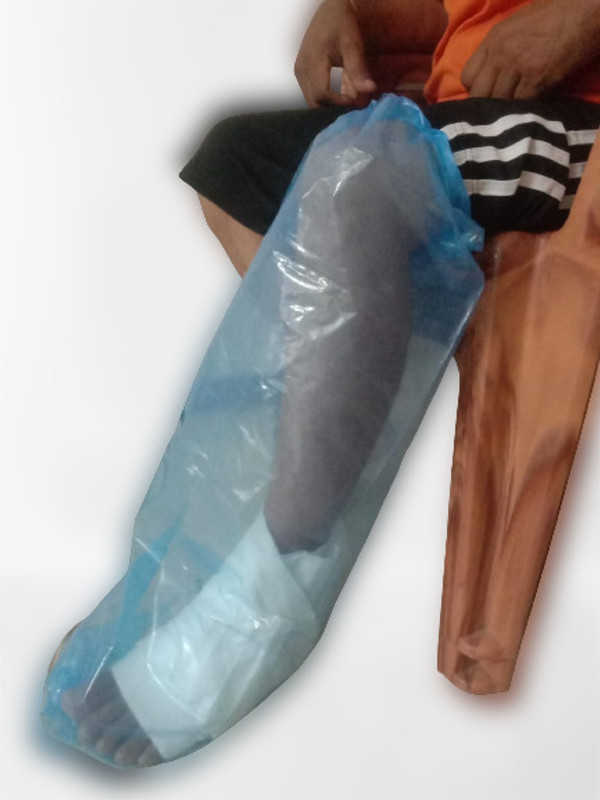 ARAMBHA CAST/DRESSING (SHOWER SLEEVE) Bandage Protector(Adult & Kids Long Leg, Short Leg, Foot, Long Arm, Knee, Hand)