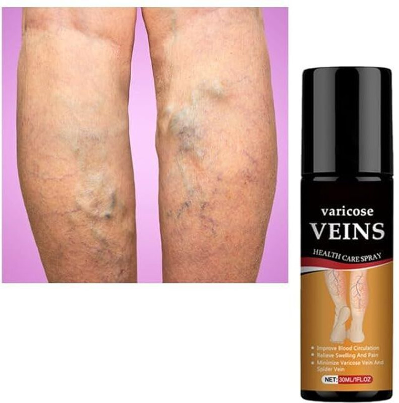 MSVTRADESS Varicose Vein Spray Natural Spray Herbal Relief for Leg Veins and Healing Bandage Protector(Adult Foot, Knee, Long Leg)