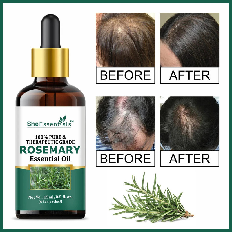 INTIMIFY 100% Pure & Natural Rosemary Essential Oil for Hair Growth, Hairfall & Skin Care(30 ml)