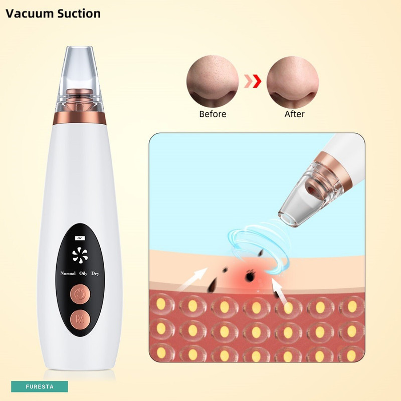 Lunvix Plastic Blackhead Remover Vacuum Suction Device(Pack of 4)