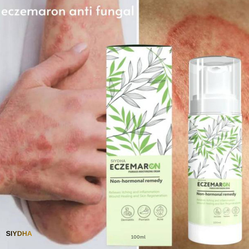 SIYDHA Eczemarcn Anti Fungal Cream Powerful Treatment For Itchy Skin Liquid(100 ml)