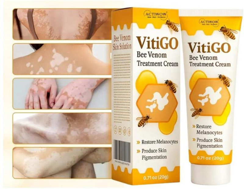 OGzGlam Vitigo Bee Venom Cream for Sun-Damaged Skin Cream(20 g)
