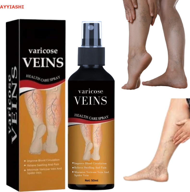 AYYIASHI Varicose Veins Relief Spray Herbal Blend Reduce Swelling Liquid(50 ml)