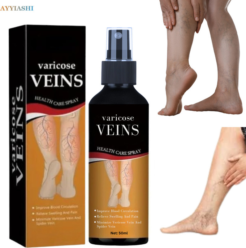 AYYIASHI Varicose Veins Relief Spray Leg Swelling Reduction Liquid(50 ml)