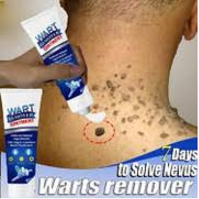 Luipui Cream Skin Tag Remover Herbal Extract cream pack of 2(1 Items in the set)